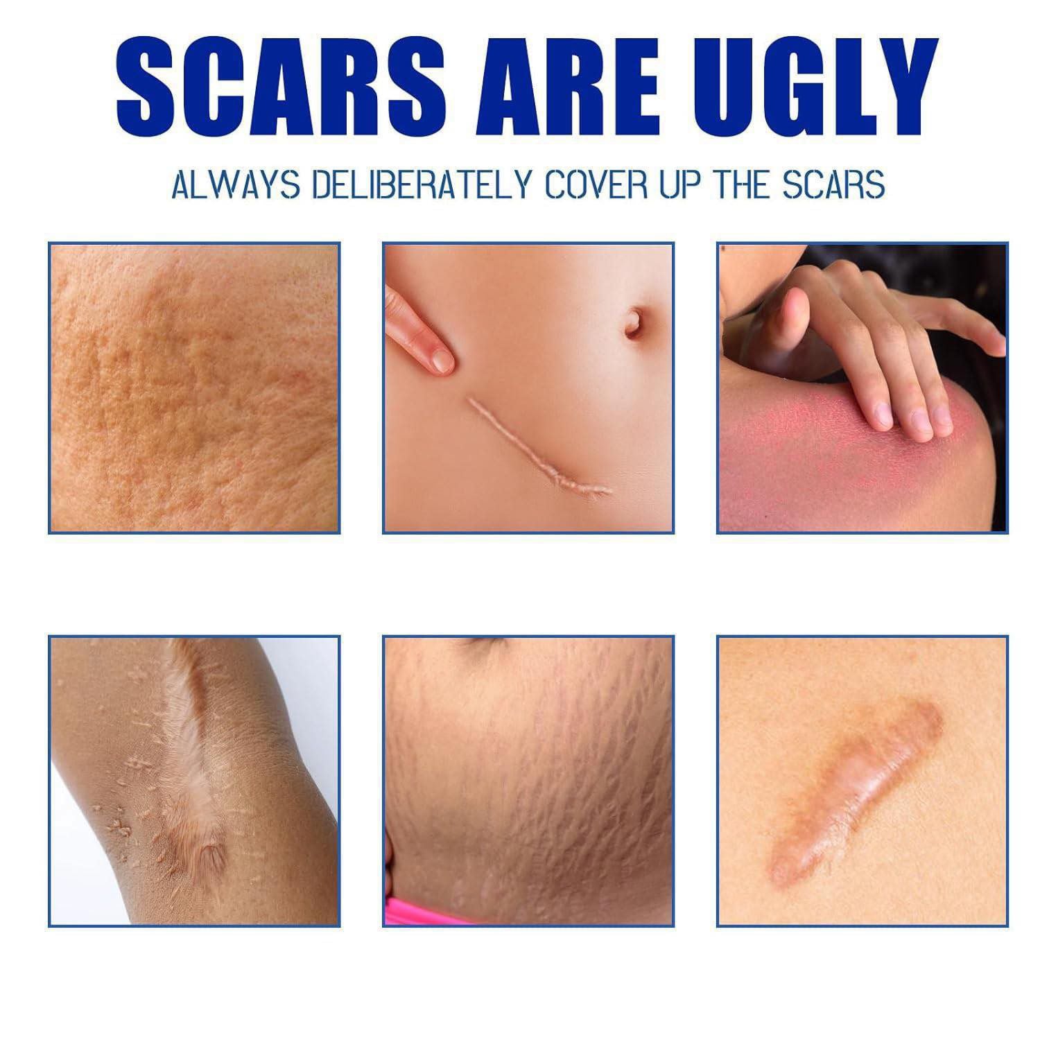 ⭐⭐⭐⭐⭐            كريم إزالة النذبات والحروق