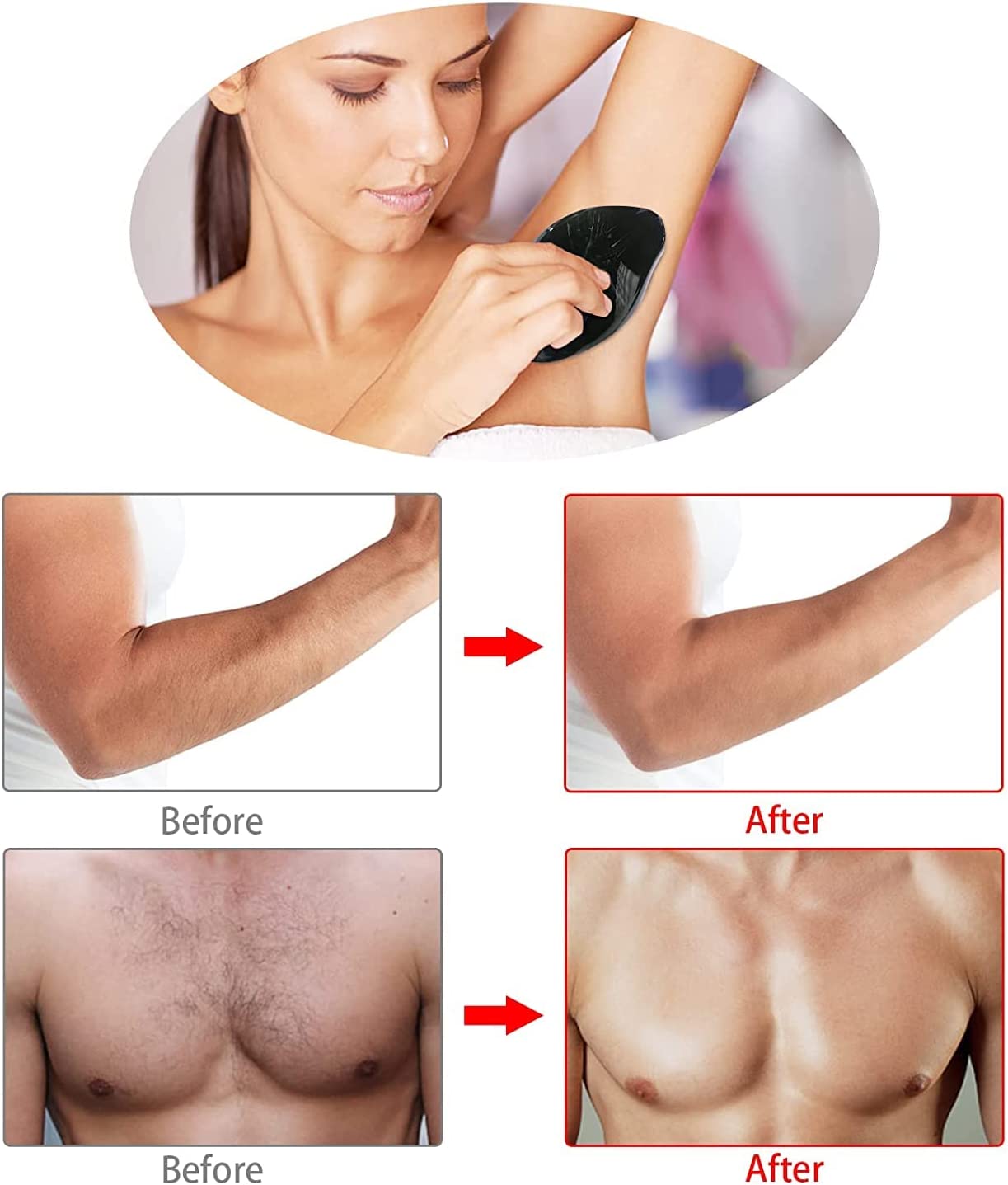 ممحاة إزالة الشعر