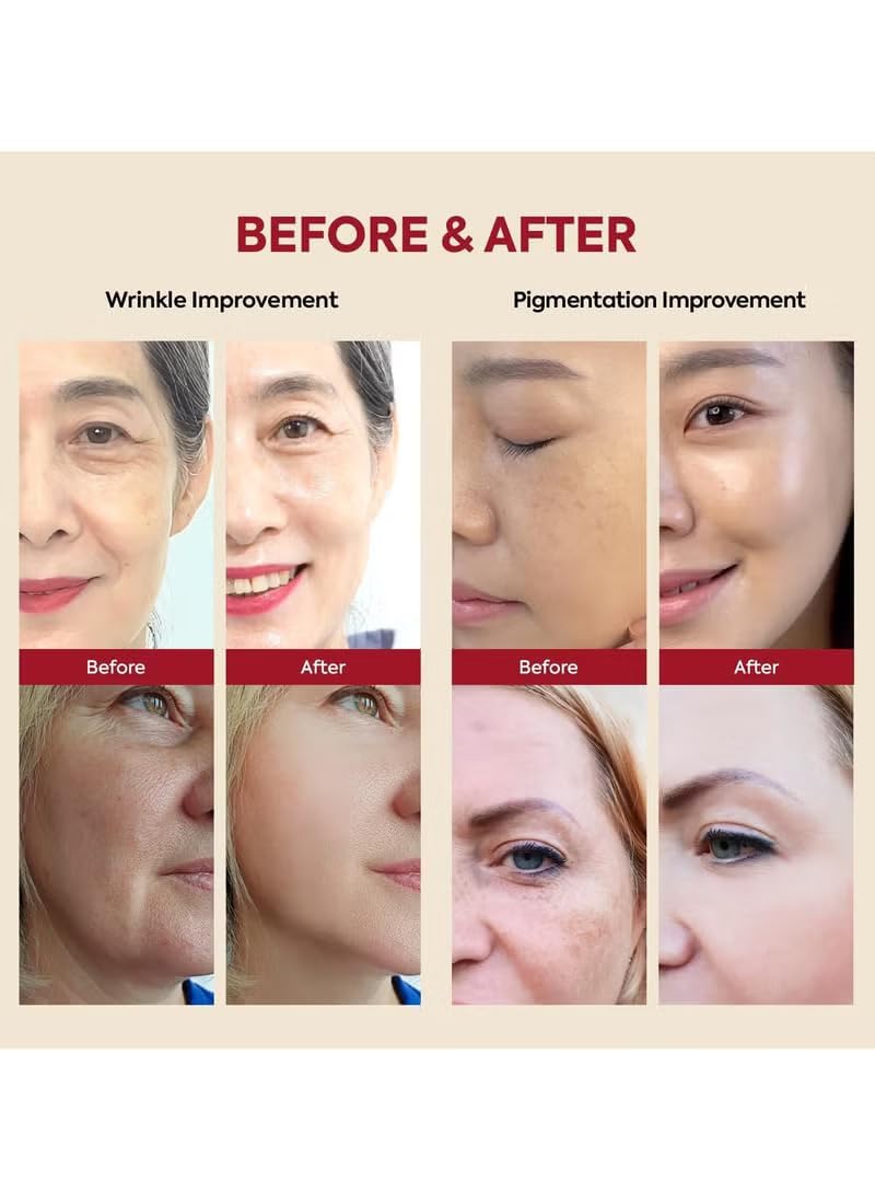 سيروم 1988 لإزالة التجاعيد من الوجه