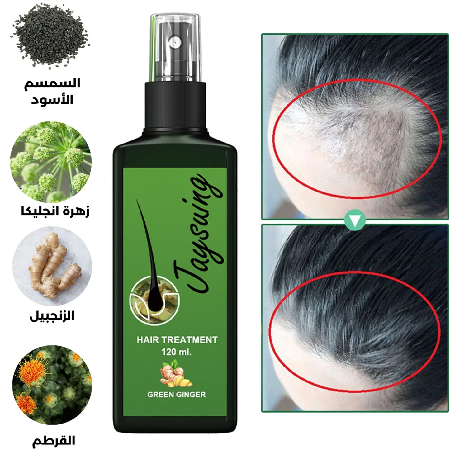 زيت جايسوينغ لعلاج تساقط الشعر